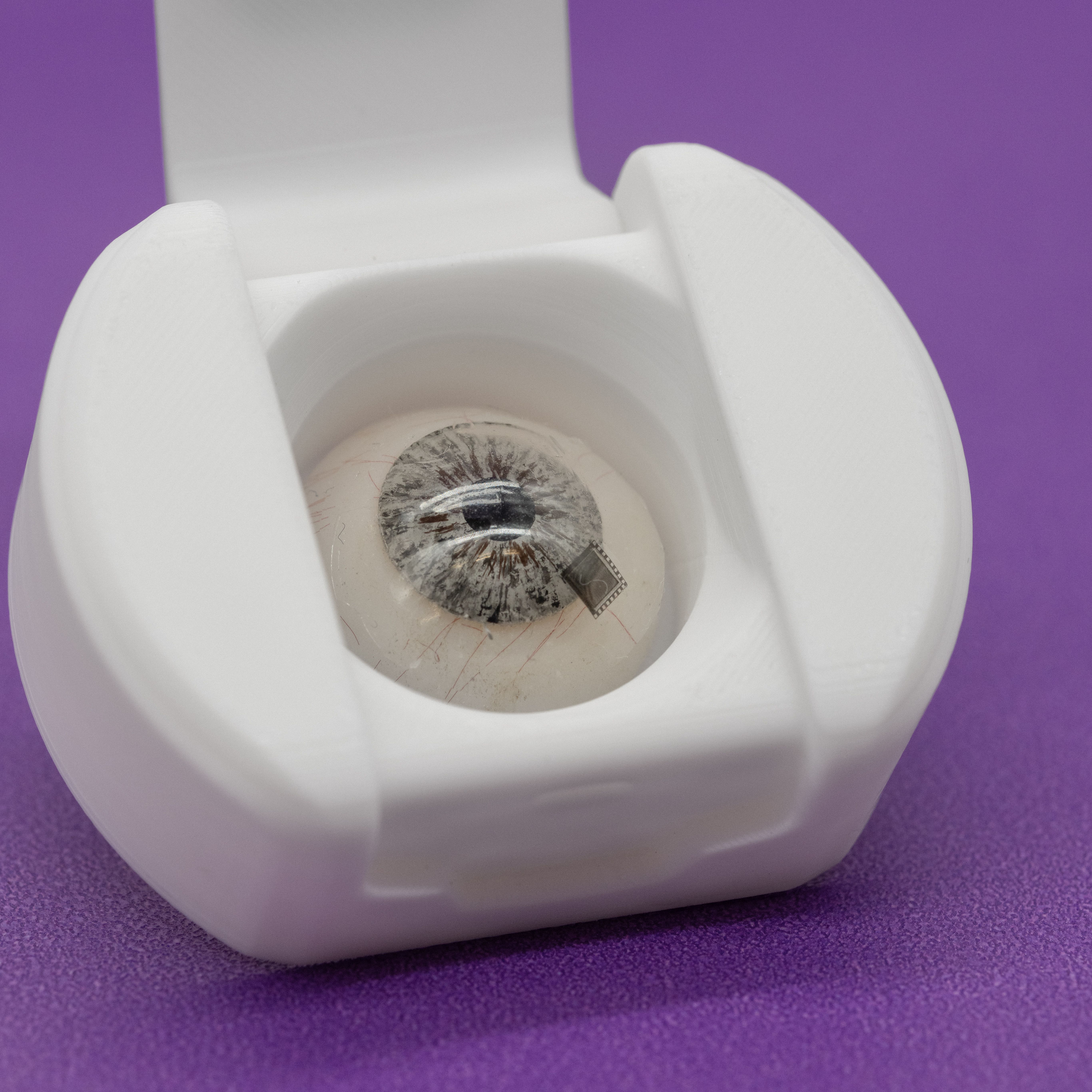 Smart Contact Lens for Glaucoma Management